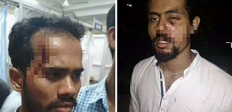 কটন বিশ্ববিদ্যালয়ৰ নিৰ্বাচনী প্ৰাৰ্থীক আক্ৰমণ