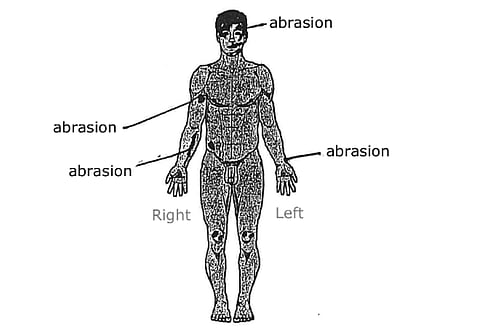 Coligny revisited: Post-mortem evidence suggests judgement of emotion, not rationality