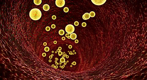 The repetition of unsound science as fact – Prof Noakes on Keys’ skewed cholesterol findings