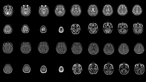 Linking computers and brains may help us further understand the mind