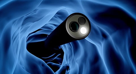 Prof Colleen Aldous clarifies the outcome of the colon cancer study as positive