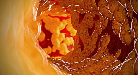 “The first principle is that you must not fool yourself” – Prof Noakes on Ancel Keys’ Cholesterol Con