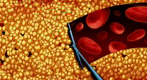 The ultimate victory of commercial interests over science – Prof Noakes on Ancel Keys’ Cholesterol Con