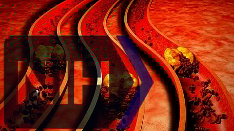 Institutional collusion and corruption runs DEEP – Prof Noakes on Keys’ Cholesterol Con