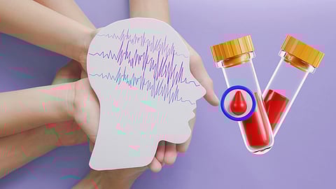 Revolutionary blood test for Alzheimer’s raises ethical questions, hope for early intervention