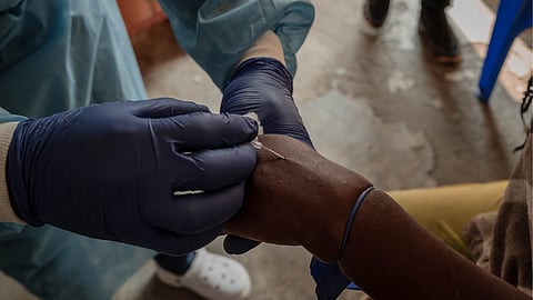 Ramaphosa says Mpox crisis in Africa is a chance to redress mistakes