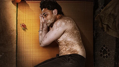 Mahesh Gowda unveils poster for Bilichukki Hallihakki, a rom-com addressing vitiligo