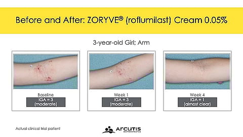 Photo: Arcutis Biotherapeutics