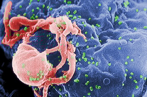 HIV cases on the rise