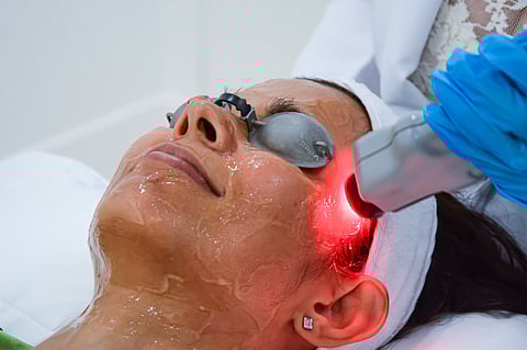 Photograph courtesy of Dr. CRB Aesthetic and Laser Clinic
Red Touch laser treatment is designed with an integrated scanner system to get the best performance in transmitting energy to the skin with an optimized ergonomics.