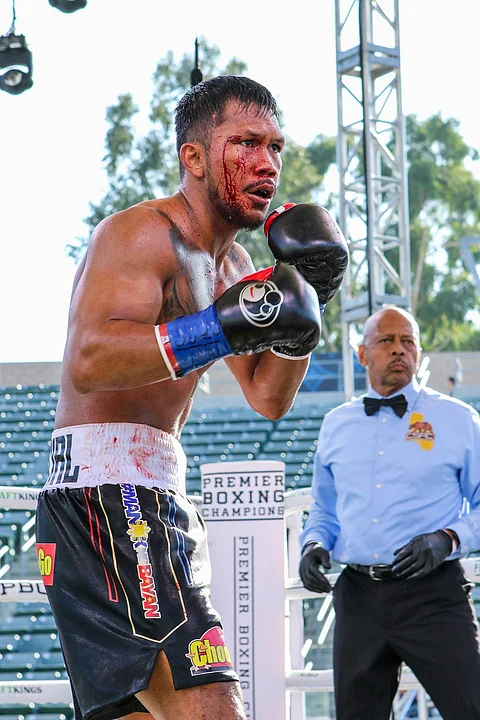 PHOTOGRAPH COURTESY
OF Eumir Marcial/FB
BLOOD flows through Eumir Marcial’s right eyebrow during his six-round bout with Steven Pichardo of the United States in Carson, California.