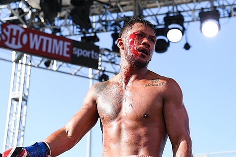 Eumir Marcial formally walks away from the national team to focus on his professional career. Photo by Jhay Otamias