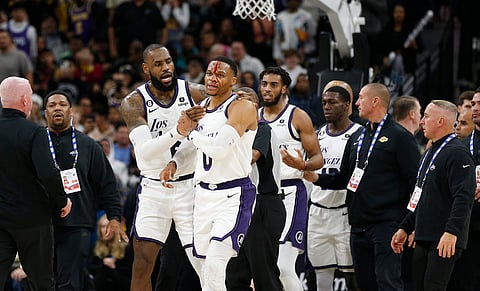 RONALD CORTES/AGENCE FRANCE-PRESSE
LEBRON James of the Los Angeles Lakers checks on teammate Russell Westbrook after getting hit by Zach Collins of the San Antonio Spurs during their NBA game. The Lakers won, 143-138.