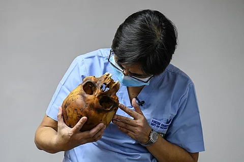 This photo taken on 17 November shows forensic pathologist Raquel Fortun inspecting the skull of a drug war victim in her laboratory at the University of the Philippines College of Medicine in Manila. - Raquel Fortun whispers to the human skeletal remains spread out in a makeshift morgue in the Philippine capital Manila. She is seeking the truth about their violent deaths -- and justice for their families. Photo by JAM STA ROSA / AFP