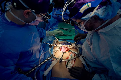 FILE PHOTO: This 14 July 2023, image released by NYU Langone Health in New York, shows a team of surgeons transplanting a pig kidney. US surgeons who transplanted a genetically modified pig kidney into a brain-dead patient announced 14 September 2023 they had ended their experiment after a record-breaking 61 days. (Photo by Joe Carrotta / NYU Langone Health / AFP)