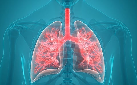 An extra bright X-ray shows a link between long Covid and pulmonary fibrosis. | W. COMMONS