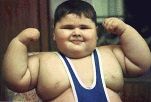 Obese teens more at risk of hearing loss