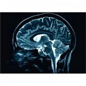 Brain circuitry that triggers overeating identified