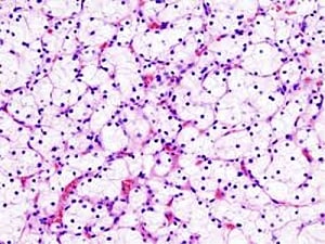 Blood vessel cell jab may repair damaged organs