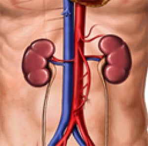 lack of donors leads to 'kidney rackets' in India
