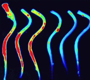 Molecular sensor detects early signs of multiple sclerosis