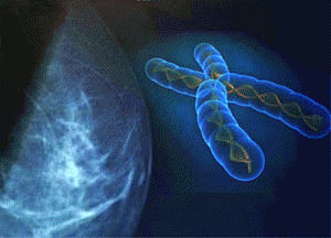 Gene important to breast development, breast cancer identified