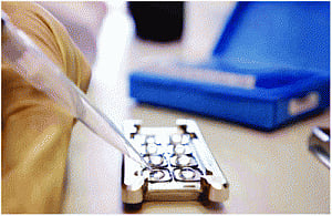 Gene saves N Indians from exorbitant breast cancer test