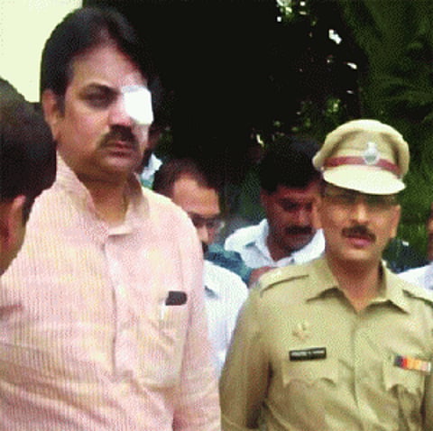 Minister sustains eye injury in ink attack