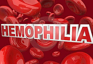 Plant cells may help treat hemophilia