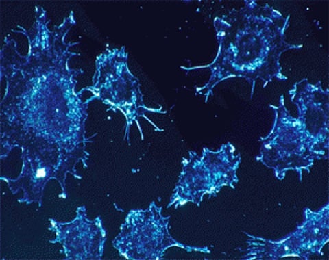 Cells that facilitate tumour growth identified
