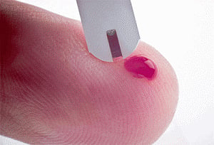 Finger prick blood tests may be unreliable: study