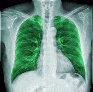 New method to produce 3D images of lungs developed