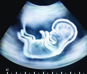 PNDT Act a failure, legalise ultrasound tests: Maneka