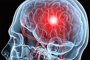 Brain's seat of speech shuts down when we talk