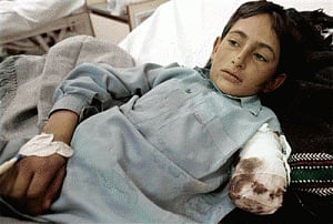 Delay in rescue leading to gangrene among quake victims
