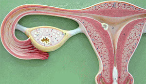 New test detects twice as many cases of ovarian cancer