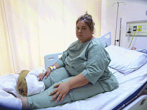Delhi hospital restores mobility to 130-kg Uzbek woman