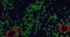 Source of liver stem cells identified