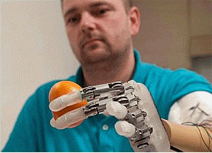 In a first, bionic finger makes amputee feel texture on his hand