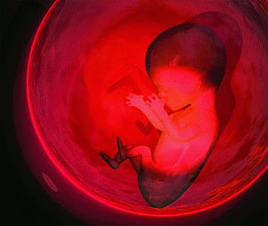 The womb industry