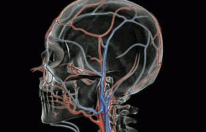 Brain injury linked to stiffened arteries