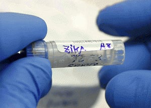 How Zika virus causes microcephaly decoded