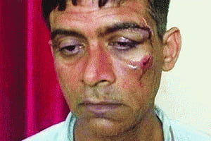 India pacifies, but African anger rages
