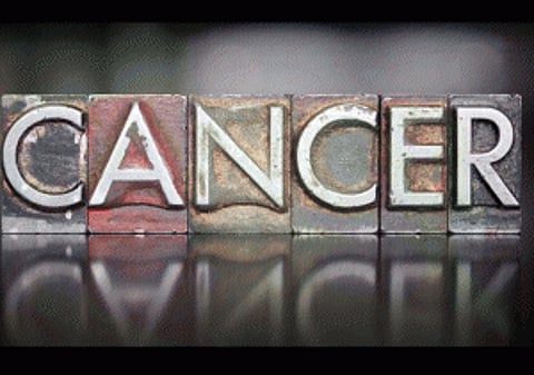 'Studying web searches may help detect pancreatic cancer'