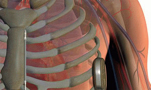 'Heart-rate correcting device may up car accident risk'