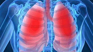 Artificial intelligence may help spot lung diseases better