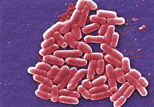 Superbugs hinder treatment of kidney infections