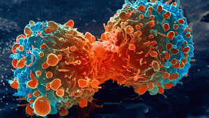 Human cells with 'built-in circuit' can kill cancer cells