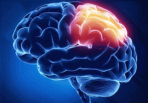 India urged to take better initiatives at stroke management