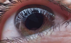 New imaging technique to detect onset of vision loss